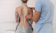 Skoliose Wirbelsäulenverkrümmung Anatomie, Haltungskorrektur. Chiropraktische Behandlung, Linderung von Rückenschmerzen.